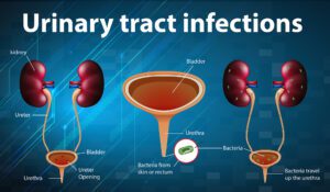 best-uro-oncologist-doctors-in-indore