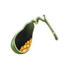 Kidney Stone Treatment by Best Urologist in Indore