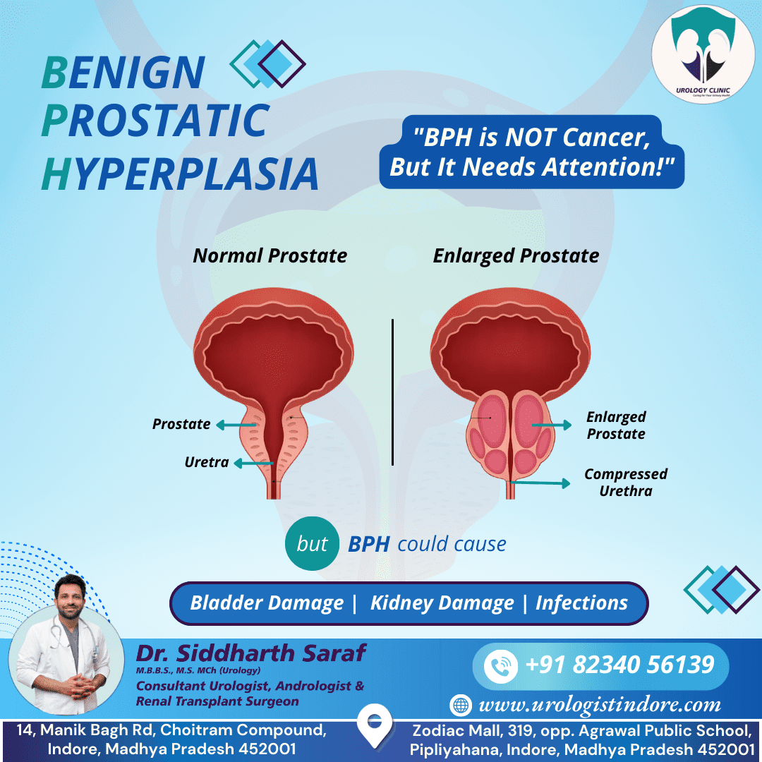 BPH - Normal vs Enlarged Prostate