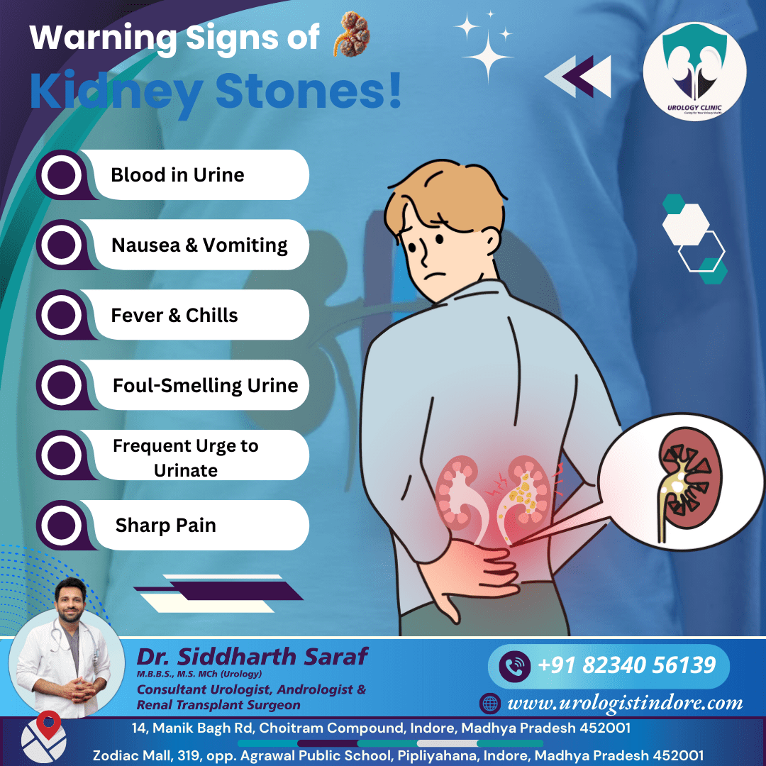 Warning Signs of Kidney Stones – Symptoms like blood in urine, nausea, vomiting, fever, chills, foul-smelling urine, frequent urge to urinate, and sharp pain. Expert care by Dr. Siddharth Saraf, Urologist in Indore.